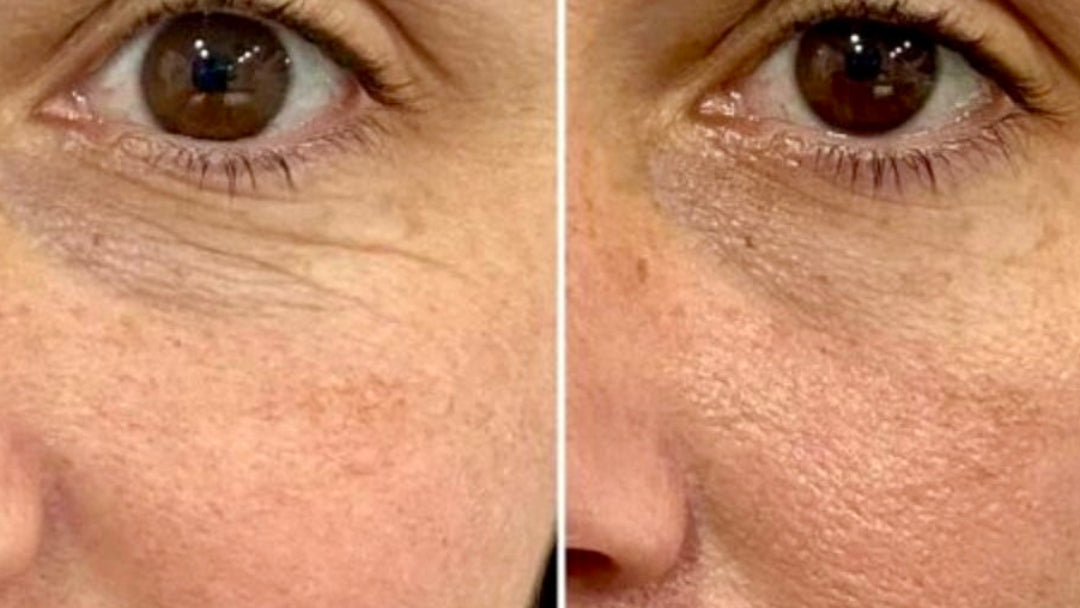 Image du Avant/Après avec le gel contour des yeux à la canneberge du Québec ARTIST